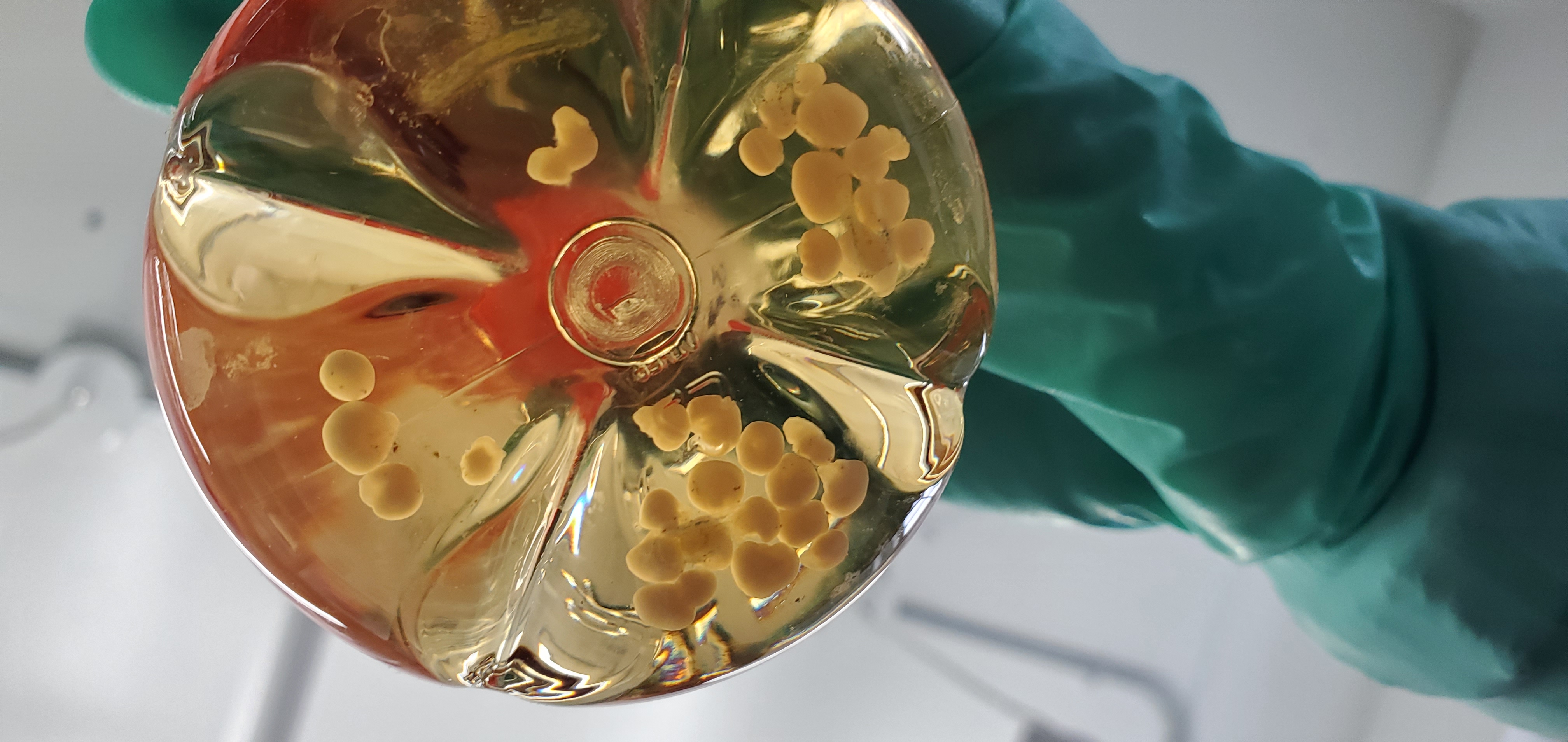 Organoïdes cérébraux humains en laboratoire