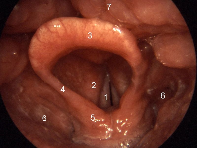 Vue laryngoscopique d’un larynx humain et de ses cordes vocales